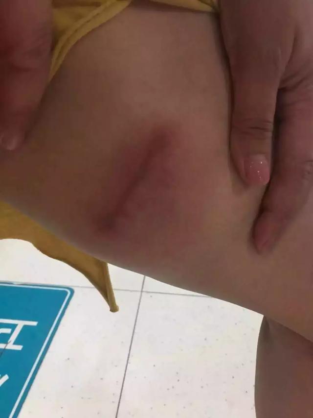 夏家河里的它比河豚還要毒