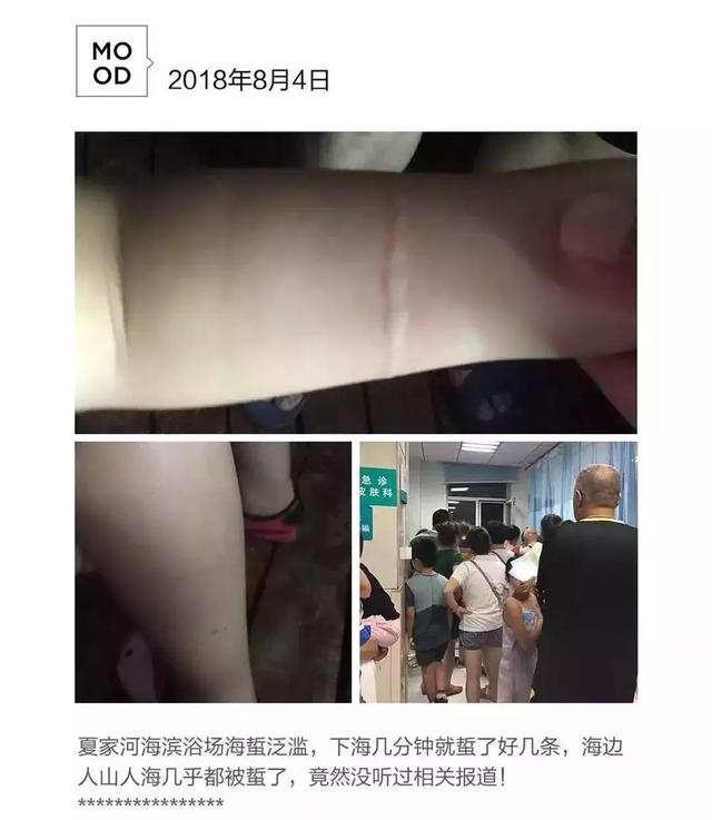夏家河里的它比河豚還要毒