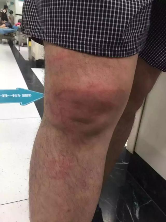 夏家河里的它比河豚還要毒
