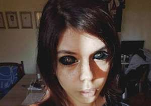 給美女染色(波蘭美女趕時髦竟去染色眼球，手術失誤致失明，雙眼漆黑如喪尸)